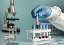 hand-with-protective-gloves-holding-blood-samples-covid-test